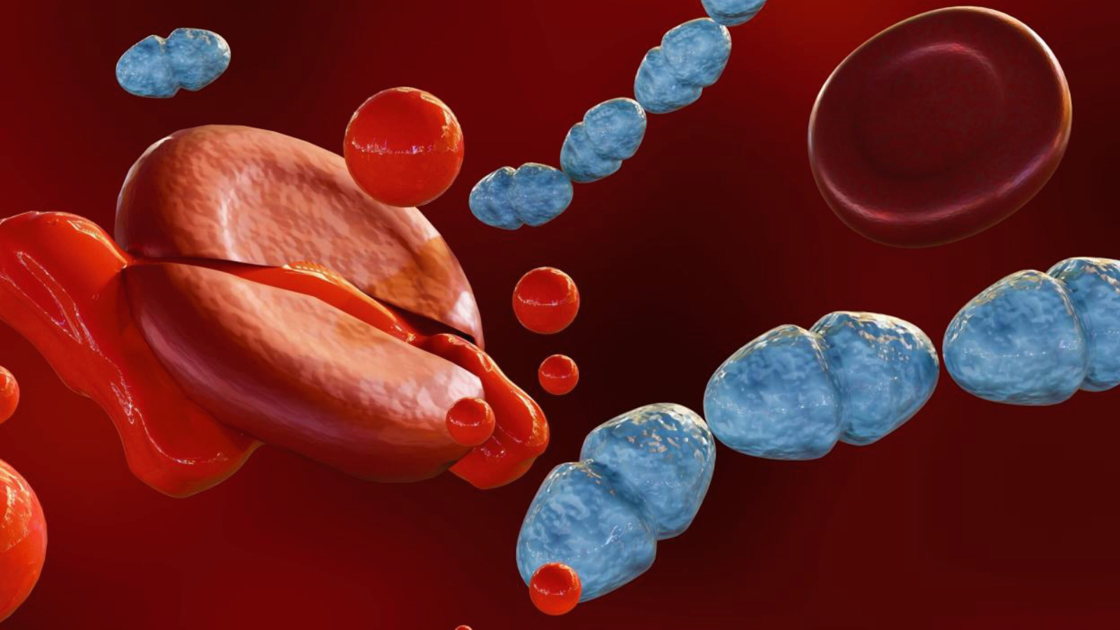 yilda 11 milyona yakin can aliyor dikkat herkes risk grubunda fVS3FOLv